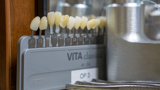 Closeup of discolored teeth for restoration